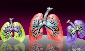 1759771949667-ilustrasi-tbc-paru-1747643368115_169