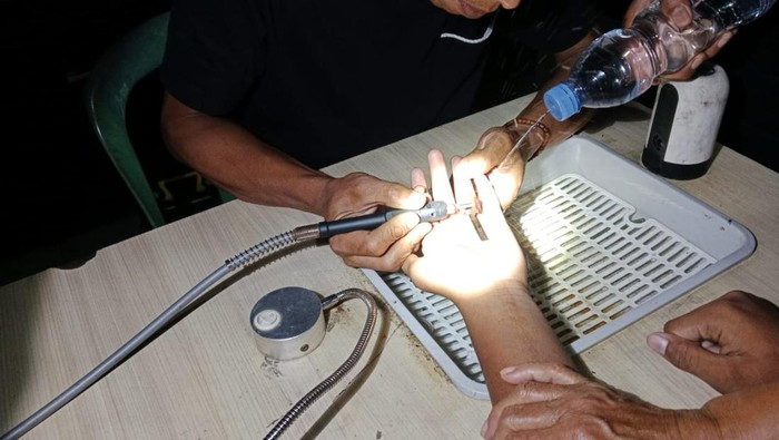 1763206009214-damkar-kuningan-saat-mencoba-melepaskan-cincin-di-jari-seorang-anak-1763178277087_169