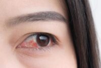 1765429546590-ilustrasi-mata-merah-atau-konjungtivitis-atau-iritasi-mata-sensitif_169
