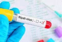 1769533532815-virus-nipah-1769497226915_169